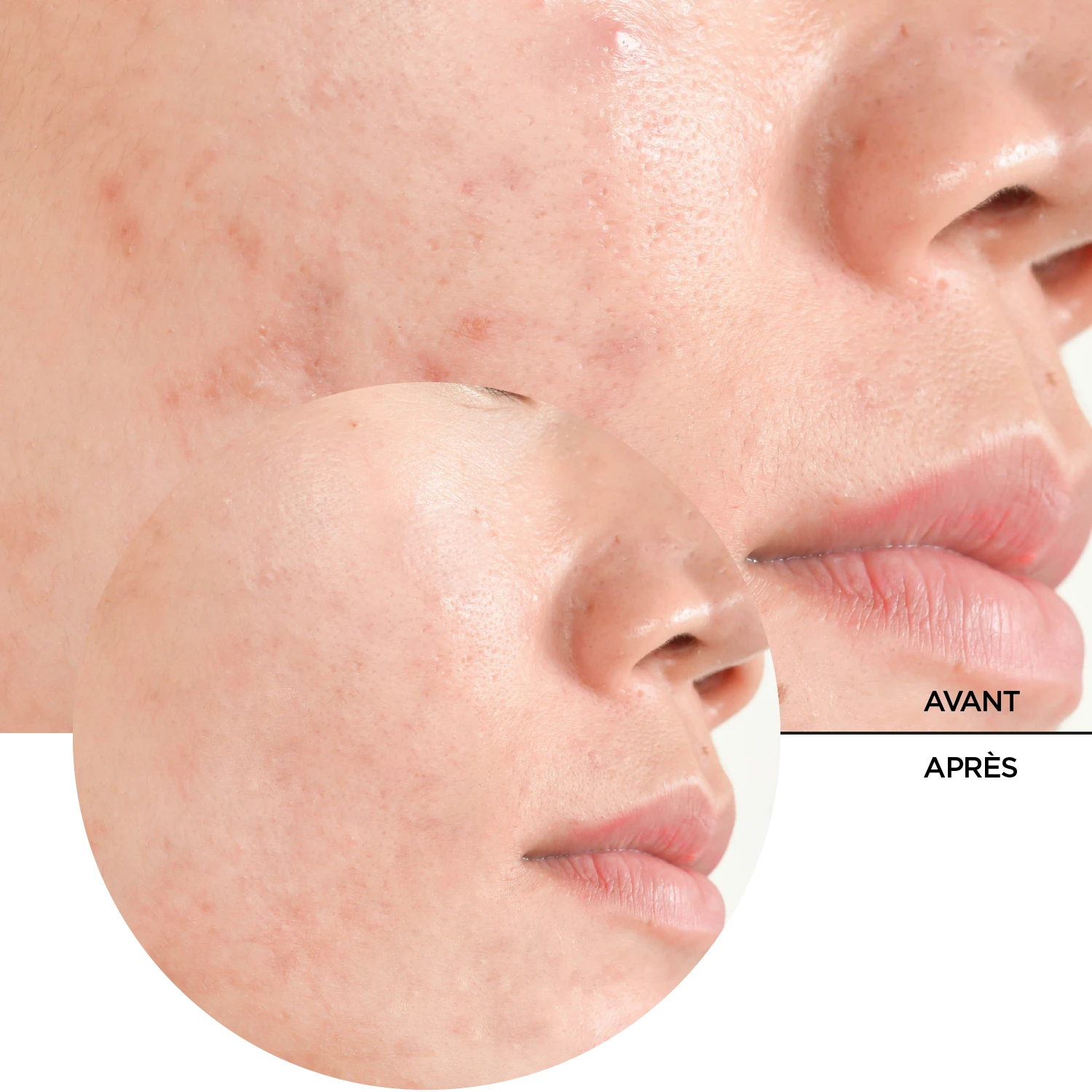 JUST Acide Salicylique 2% – Image 8