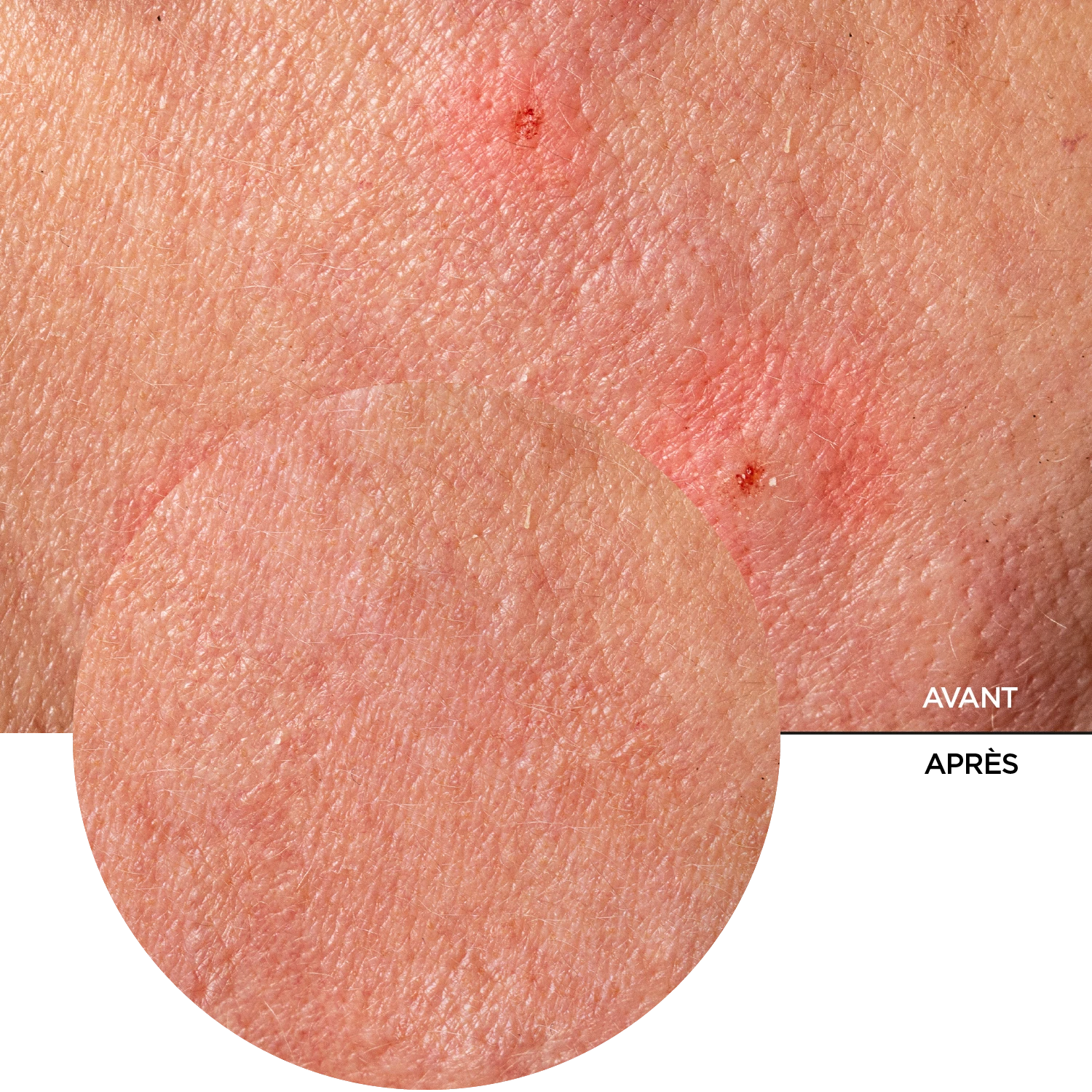 JUST pro vitamine B5 & Centella – Image 8